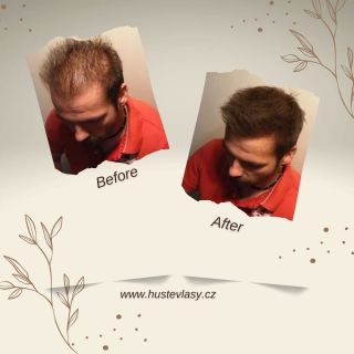 Podívejte se na rozdíl, který může Mane vlasový zesilovač přinést vašim vlasům! 🌟 Před a po 👱‍♀️👱‍♂️ Vyzkoušejte a...